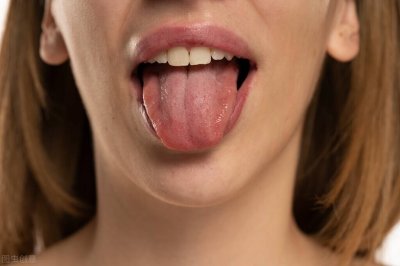 ​看舌象，辨体质，教大家分辨6种中医常见舌象
