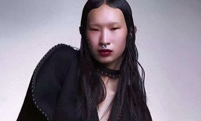 ​有种颜值叫林永健“女儿”，中国人嫌她丑，外国人却觉得她很漂亮