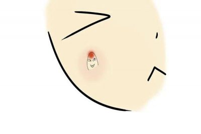 ​面部三角区的痘痘不能挤会存在感染风险