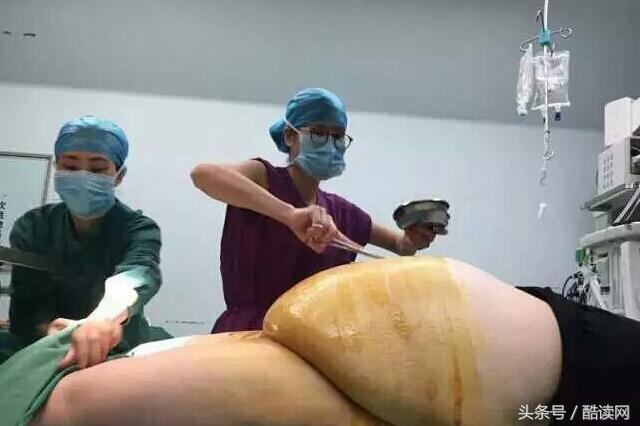 title: '孕妇死后也能产下“棺材子”?只靠腐败气体助力?',