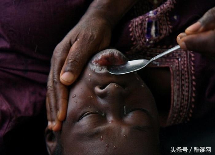 title: '孕妇死后也能产下“棺材子”?只靠腐败气体助力?',