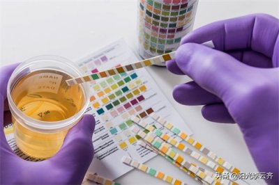 ​社区戒毒人员坐飞机和高铁时，如何避免尿液毛发测毒的尴尬