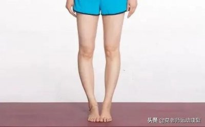 ​2种O型腿——5个有效的运动方法